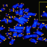 Telomere length alterations in microsatellite stable colorectal cancer and association with the immune response