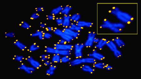 Telomere length alterations in microsatellite stable colorectal cancer and association with the immune response